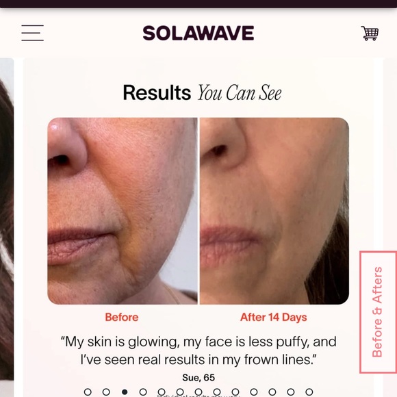 Solawave Radiant Renewal Wand nwt - Picture 2 of 4